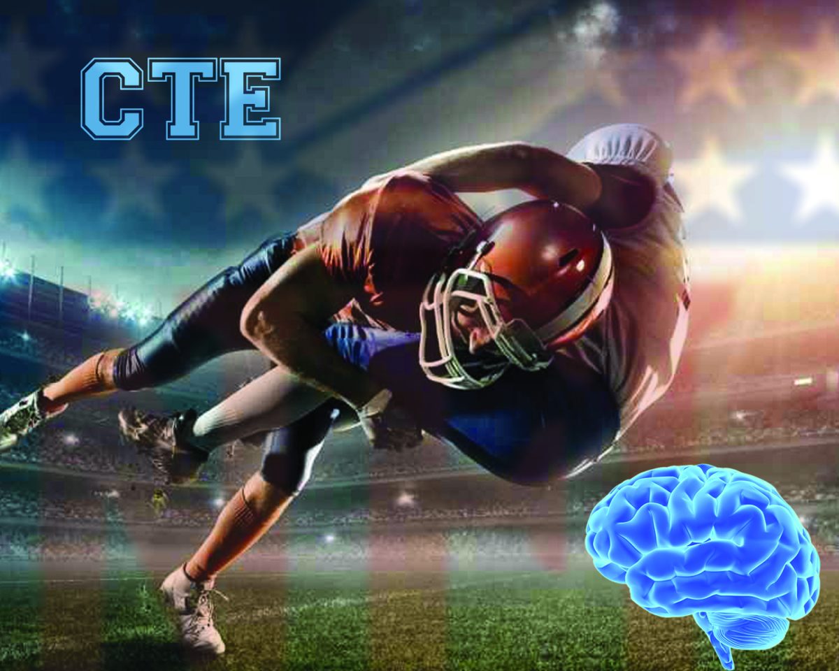 Health First, Football Later: NFL Tackles Concussions